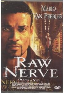 Raw Nerve
