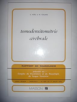 Tomodensitométrie cérébrale,